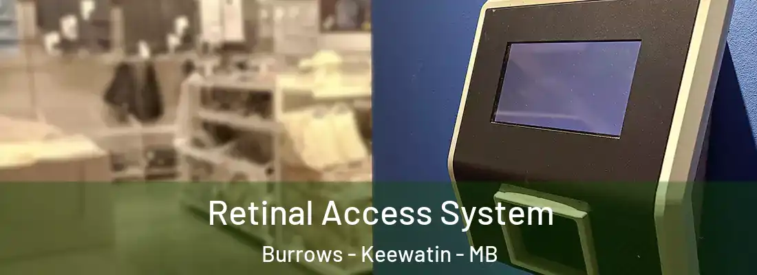  Retinal Access System Burrows - Keewatin - MB