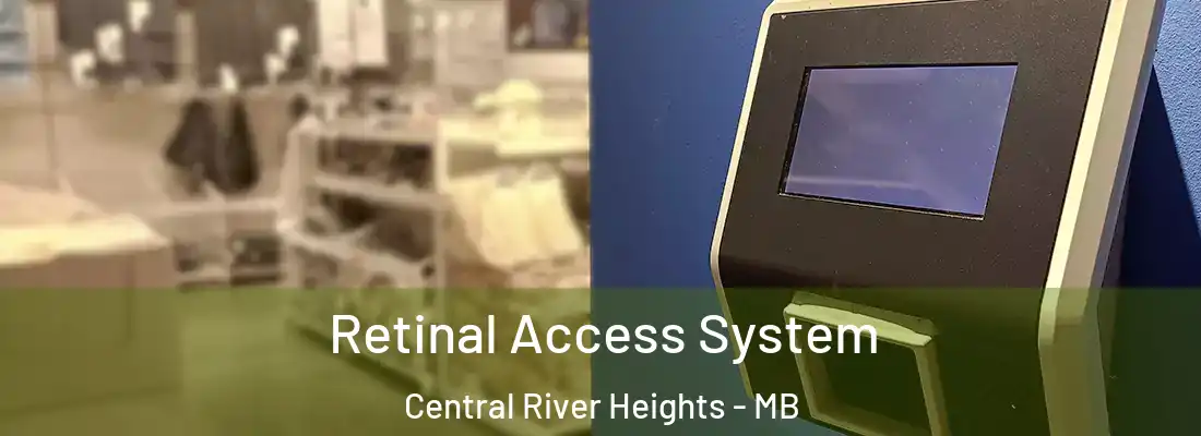  Retinal Access System Central River Heights - MB
