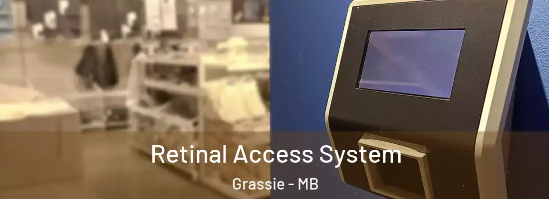  Retinal Access System Grassie - MB