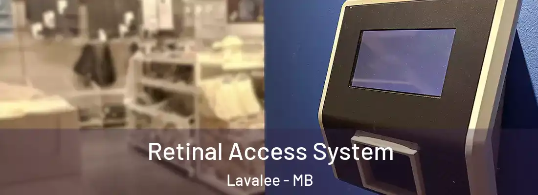  Retinal Access System Lavalee - MB