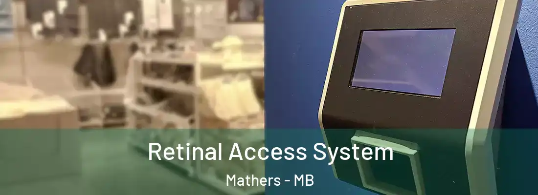  Retinal Access System Mathers - MB