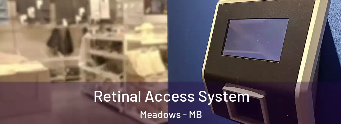  Retinal Access System Meadows - MB