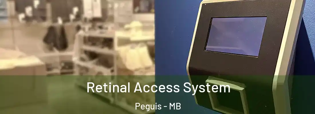  Retinal Access System Peguis - MB