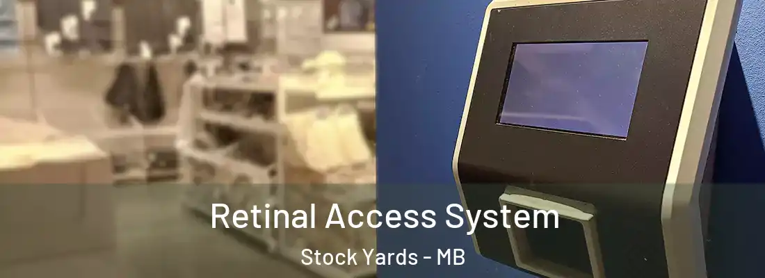  Retinal Access System Stock Yards - MB