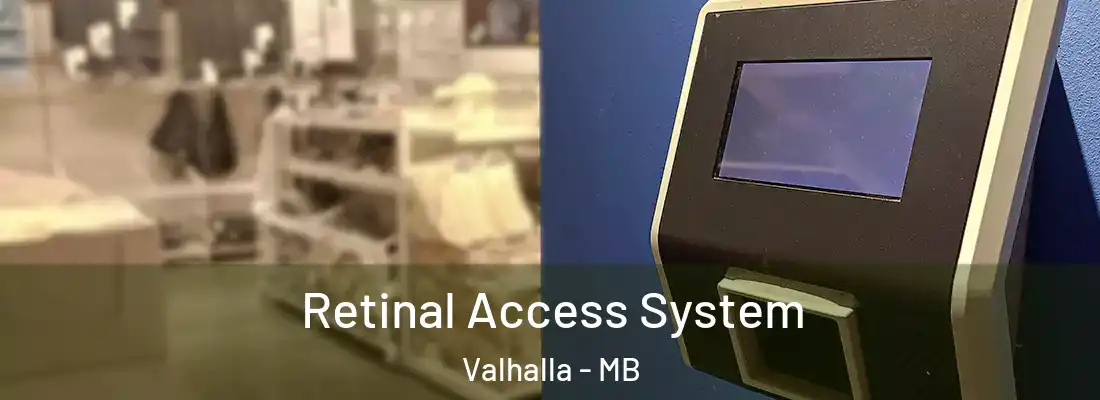  Retinal Access System Valhalla - MB